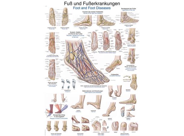 Plakat Foot and foot diseases AL528